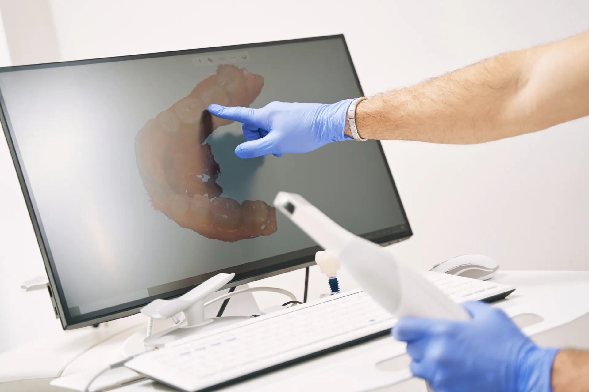 A dentist pointing to a digital 3D model of a patient's teeth on a monitor