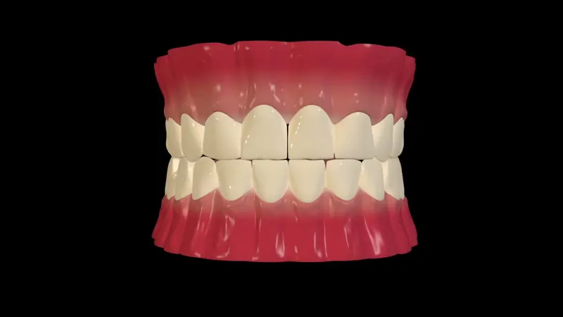 3D animation still of a tooth being prepared for a crown