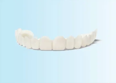 Snap-On Smile arch shown outside the mouth