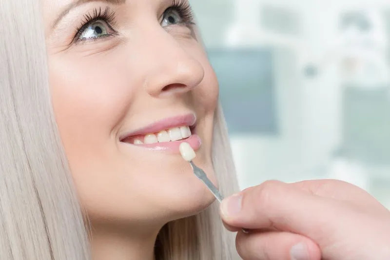 Dentist comparing a resin shade with a patient's teeth