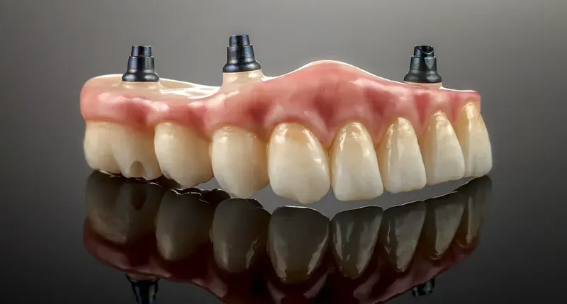 A removable overdenture that clips onto dental implants