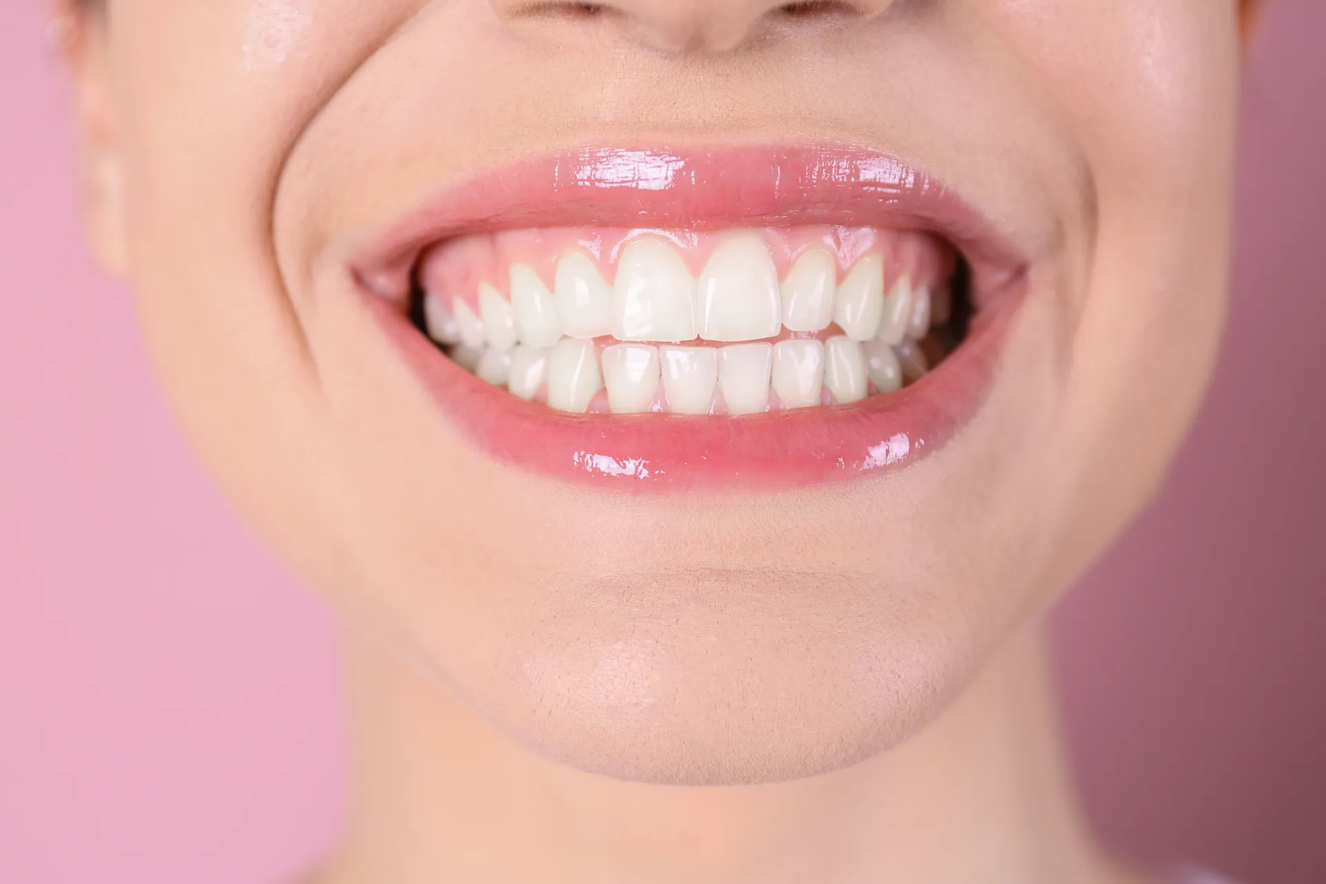 Close-up of a bright, natural-looking smile