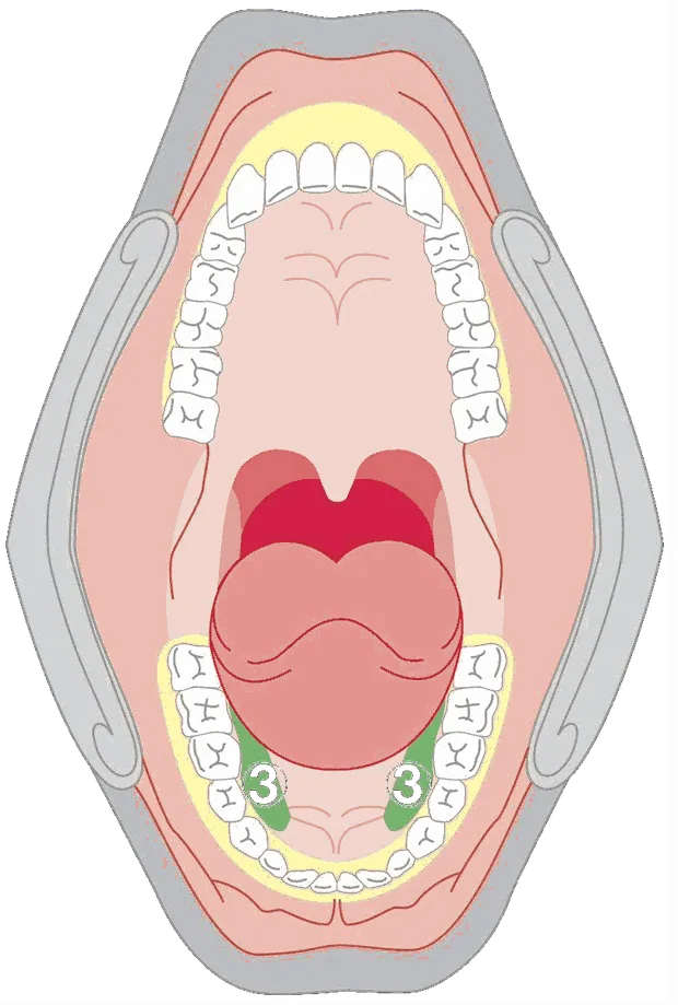 Diagram of the inside of the mouth with the base of the tongue marked as zone three.