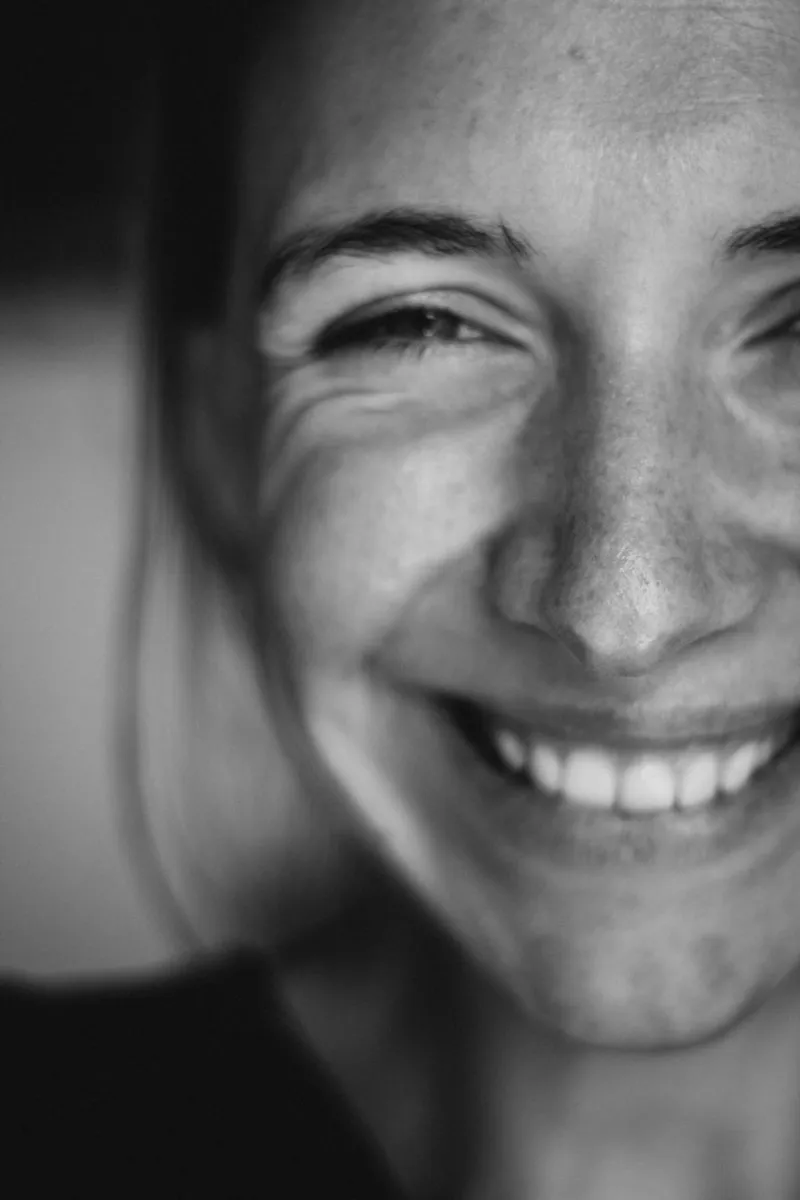 Close-up of a smile showing the upper teeth and a slim band of gum
