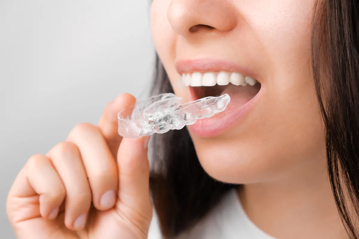 Young woman pressing a clear aligner tray onto her upper teeth