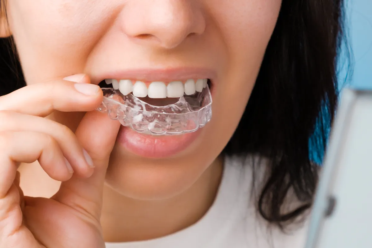 Smiling woman placing a clear aligner over her upper teeth